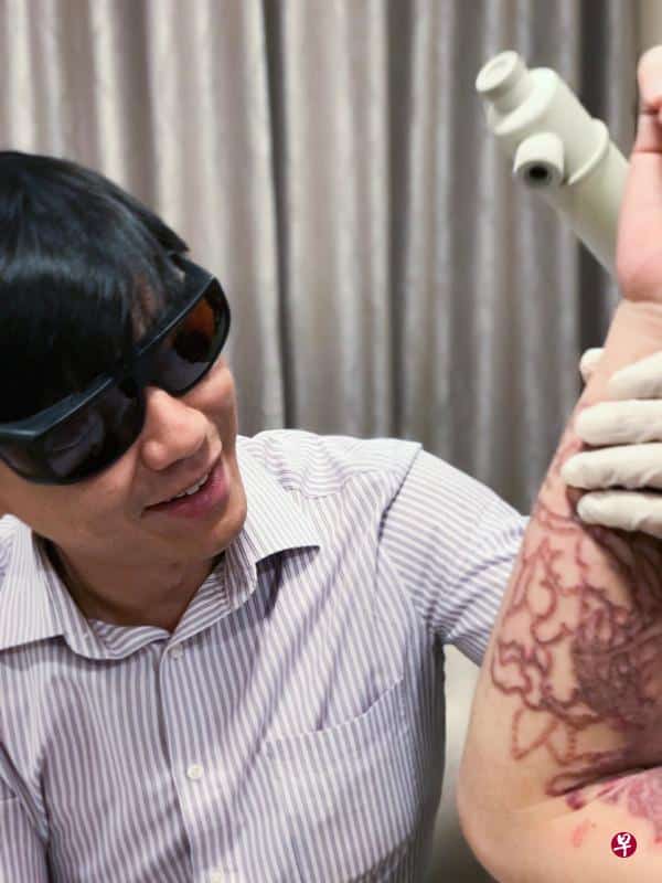 Dr. Kevin Chua doing tattoo removal