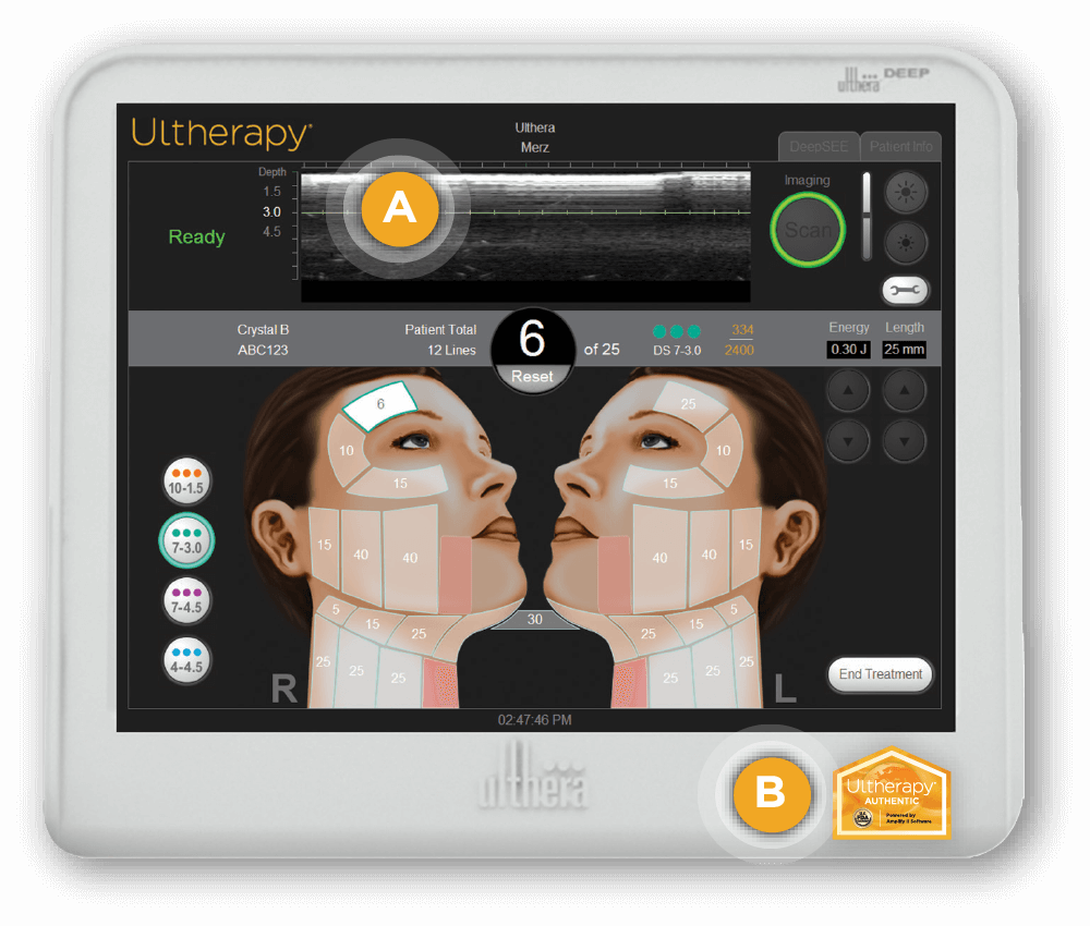 Ultherapy Machine